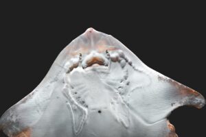 The Role of Calcium in Preventing Bone Fractures in Aging Populations